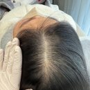 스칼프디자인센터 | 상담받고 바로 결정할 수 있었던 울산두피관리 잘하는 모마인드스칼프디자인센터