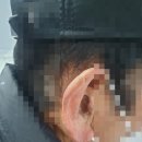박앤하독일디지털보청기 이미지