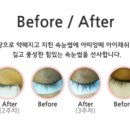 아띠네일 이미지