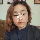 인천한빛초등학교 | 인천 서창동 피부관리샵 스킨올빛 - MTS 시술