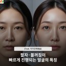 행복한여우의원 | 팔자·볼꺼짐이 빠르게 진행되는 얼굴의 특징