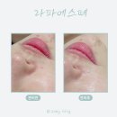 라파스킨케어 | 풍무동 피부관리 라파에스떼 스킨스켈링 김포수분관리 후기