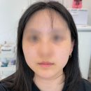 인셀덤퀸 - 완주군 | 군산 피부관리 퀸다경뷰티