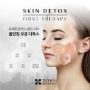 아테나스킨