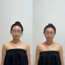 세븐일레븐 삼성8호점 | [ 송파피부관리 ] 라헨느스킨 문정동 비대칭 관리 후기