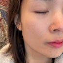 에스테틱마리에 | 의정부피부관리 더마리에 얼굴윤곽관리 베이직코스 솔직 후기