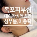 에드가5차 | [목포/남악스킨케어] 심부볼이랑 이중턱이 고민될때는 &#34;데이왁싱 앤 스킨&#34; / 뷰티멀티샵 ( 탈모, 왁싱...