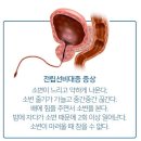 맨플러스