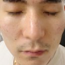 리앤리의원 | 올인원시술 후기(at.리앤리가정의학과)