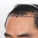 맥스웰피부과의원 이미지