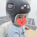 이노야드 두상교정센터 석촌호수 네이버블로그