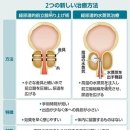 전립선비대증 40~50대에 비대하기 시작해 80대에서는 9할에…내시경을 사용한 2가지의 신치료 등장 이미지