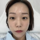 진다리로 | 광주 다크서클커버 전문, 오닛에서 받고 달라진 인상 후기