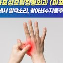 손바닥 통증 원인 치료 증상 방아쇠수지증후군 수근관증후군 말초신경병증 이미지