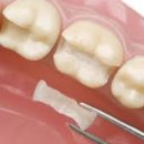 튼튼치과기공소 이미지