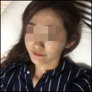 여드름피부과 고민하다가 한의원 치료까지 받아본 후기
