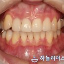 하늘치과기공소 이미지