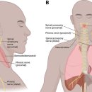Re: 안면신경 synkinesis이외 brachial plexus synkinesis, respiratory synkinesis 탐구 이미지