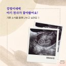 리본산부인과의원 | [공지] [임신 일기 3, 4주차] 임신 초기 증상 | 임테기 역전 | 아기집 초음파 후기