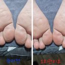 남양주산전산후마사지 위더스산후케어 남양주구리점 후기