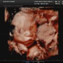 연세맘스그린여성의원 이미지