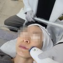 메디필즈의원 | 대구 달서구 피부과 텐써마 솔직후기 메디필즈의원