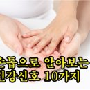 손톱으로 알아보는 건강신호 10가지 이미지