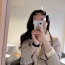 한쪽보조개 수술 1년차 후기