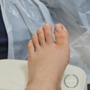 엄지모터스 | 구리내성발톱 포쉬네일 하이푸스 출산 전 문제성 발관리 완료 갈매내성발톱