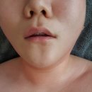 다비다세탁 | [마지끄에스테틱 동탄 목동 피부관리실]일반관리후기 수기+ 괄사 /일반관리받았어도~ 프리미엄관리급^^