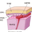 별다른 이 없는 뇌동맥류의 위협 지주막하출혈 위험성과 예방방법 이미지