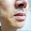 7010 | 조아스 프리미엄 트리플 블레이드 전기면도기 JS-7010 사용 후기