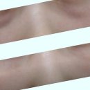 리프업의원 | 여리여리 볼륨감, 입술 필러 결과 좌우하는 결정적 3가지 비밀을 파헤쳐 봐요!