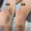 WR(부산광역시 북구)-[화명대로]-상-9 | 왁싱 화명동남자왁싱 화명동왁싱추천 화명동미용실 화명동두피문신 찰리스칼프앤왁싱후기 [겨드랑이왁싱]