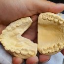 명인치과기공소 이미지