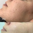 필바이오 이미지