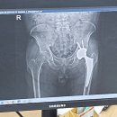 화순전남대학교병원1층 암연구센터 앞 화장실 | [공지] 조선대병원 외래진료 후기 80대 아버지 방광암 수술 고관절 인공관절 치환술 경과 수술후 3개월차