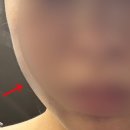 동신한방병원 | 목동 피부관리 및 신부관리 결이고은 목동점 솔직후기