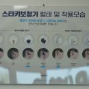 스타키보청기 김포센터 이미지