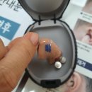 탑 독일 보청기 이미지