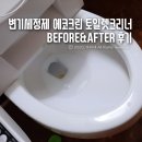 에코크린샷 | 변기세정제 에코크린 토일렛크리너 비포에프터 후기