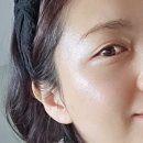 이브피부미용