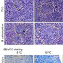 Mycobacterium salmoniphilm을 인위 감염후 5℃와 15℃에 사육한 무지개송어 비장의 변화 이미지