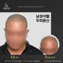 노스탈