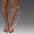 체형교정 태권도 이미지