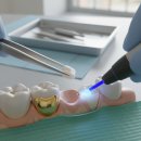 진치과기공소 | 인레이 종류부터 가격까지, 치과 호갱 탈출하고 온 솔직 후기 (금, 세라믹, 지르코니아)