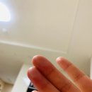 감일정형외과의원 | 감일정형외과의원에서 화상치료 받았어요. 주차가능, 토요진료