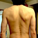 은평바른한의원 이미지