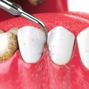 더서울디지털치과의원 이미지