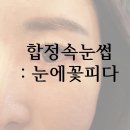 눈에꽃피다
